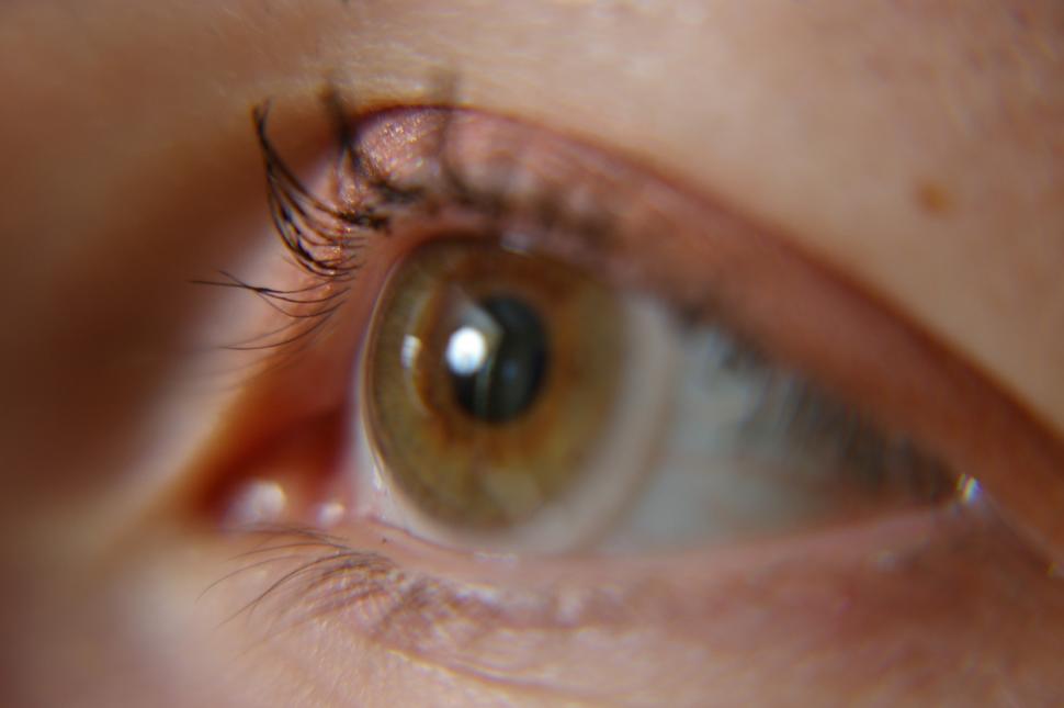 Nerf Guns and Eye Injuries  Eye & Vision Care Optometric Group